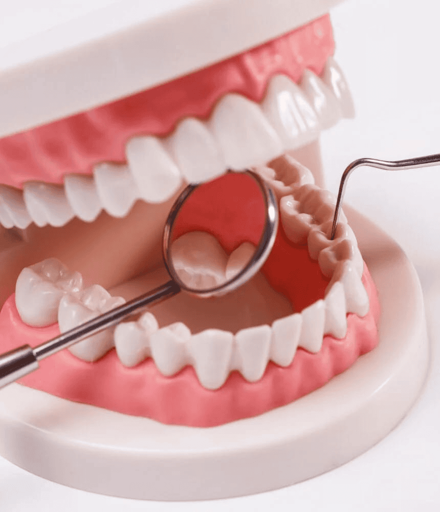 Complete and Partial Dentures