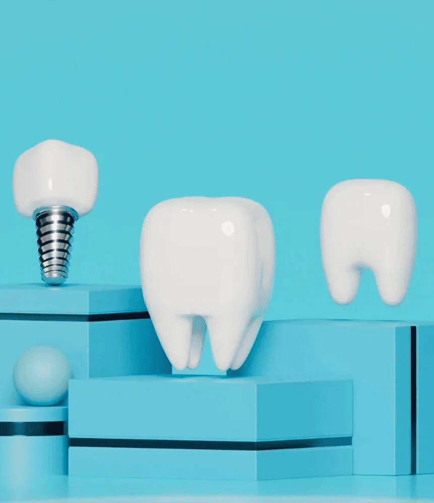 Dental Implants